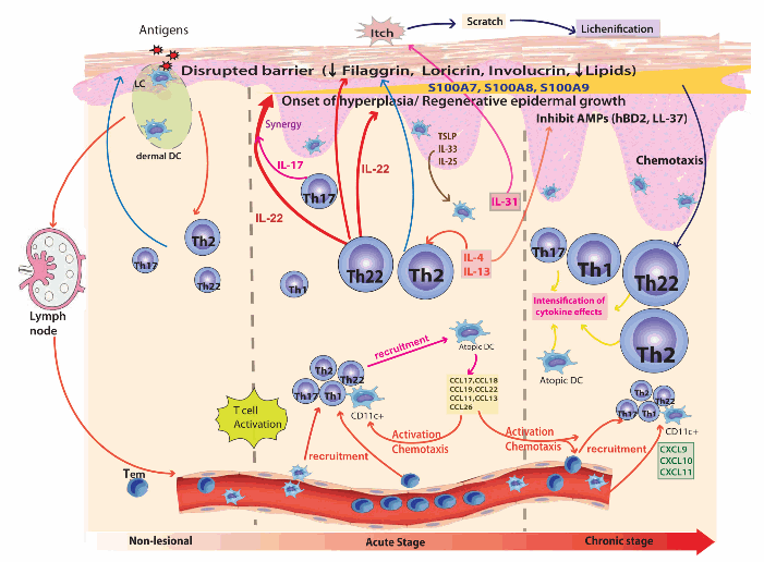 Atopic Dermatitis Pathway